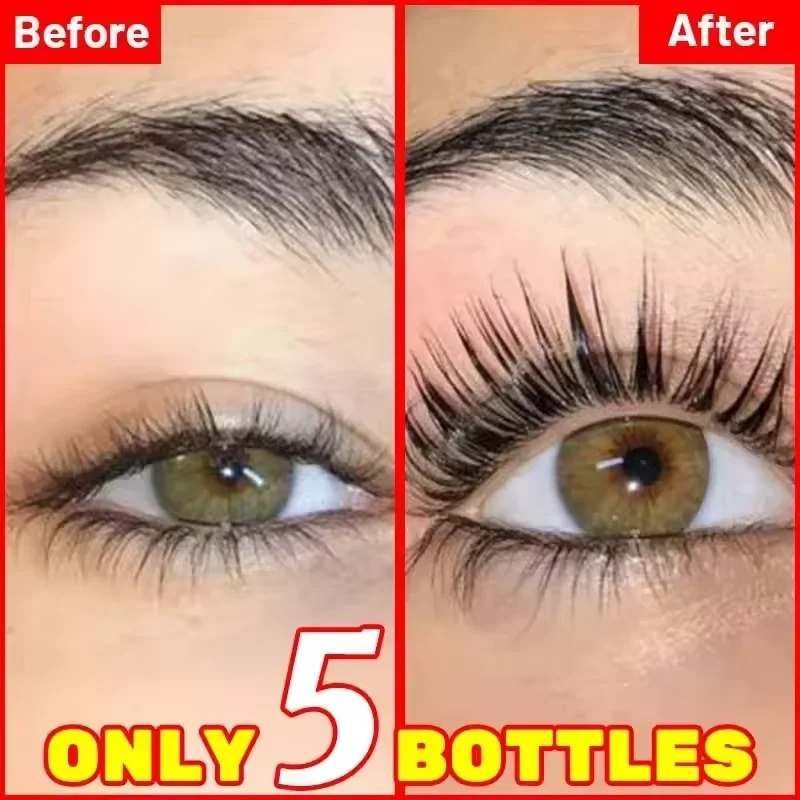 7-Tage-Wimpernwachstumsserum f – Lash Serum Growth Bewertung und Preis