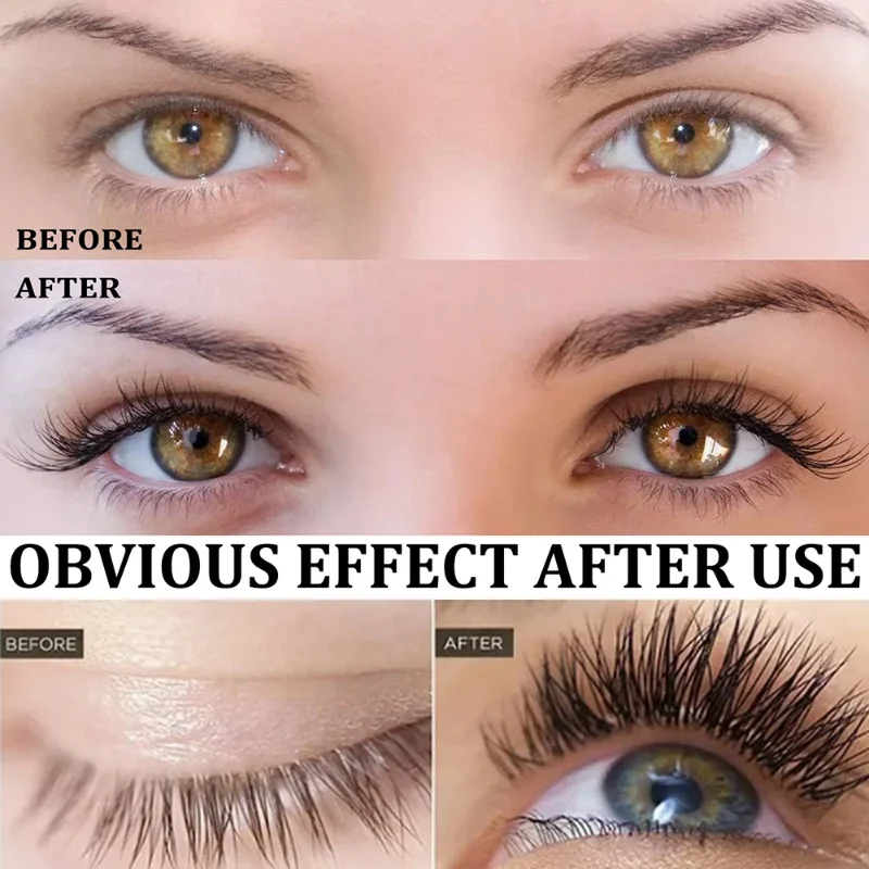 Wimpern schnelles Wachstum Ser – Lash Serum Growth Bewertung und Preis